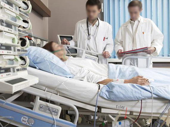 How do nurses perform a Foley catheter insertion?